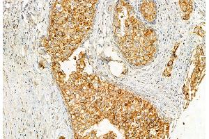 ABIN6262304 and ABIN6272944 at 1/100 staining Human normal tissues adjacent to lung cancer by IHC-P.