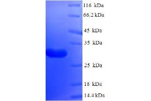 SDS-PAGE (SDS) image for Nanos Homolog 2 (NANOS2) (AA 1-138), (full length) protein (His-SUMO Tag) (ABIN5709987) (NANOS2 Protein (AA 1-138, full length) (His-SUMO Tag))
