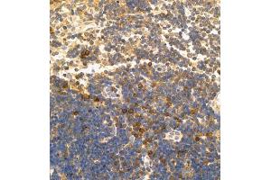 Immunohistochemistry of paraffin embedded mouse lymph node using CD30 (ABIN7076073) at dilution of 1:600 (400x lens) (TNFRSF8 antibody)