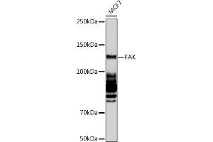 Western blot analysis of extracts of MCF7 cells, using FAK pAb (ABIN6131637, ABIN6135867, ABIN6135868 and ABIN7101374) at 1:1000 dilution. (FAK antibody)