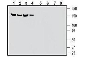 Western blot analysis of mouse kidney membranes (lanes 1 and 5), rat pancreas lysates (lanes 2 and 6), mouse brain membranes (lanes 3 and 7) and rat brain lysate (lanes 4 and 8): - 1-4. (SLC28A3 antibody  (Extracellular))
