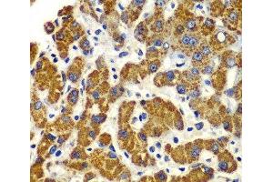 Immunohistochemistry of paraffin-embedded Human liver damage using SMAD9 Polyclonal Antibody at dilution of 1:100 (40x lens). (SMAD9 antibody)