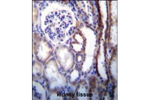 ATP6V1B1 Antibody immunohistochemistry analysis in formalin fixed and paraffin embedded human kidney tissue followed by peroxidase conjugation of the secondary antibody and DAB staining. (ATP6V1B1 antibody  (AA 284-310))