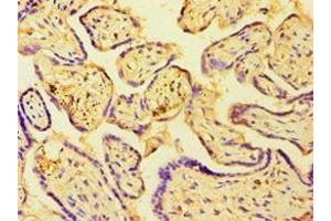 Immunohistochemistry of paraffin-embedded human placenta tissue using ABIN7154835 at dilution of 1:100 (C14orf94 antibody  (AA 1-363))