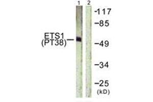 Western blot analysis of extracts from HeLa cells treated with Serum 20% 15', using ETS1 (Phospho-Thr38) Antibody. (ETS1 antibody  (pThr38))