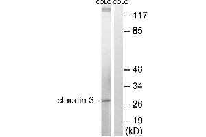 Western blot analysis of extracts from COLO cells, treated with EGF (200ng/ml, 30mins), using Claudin 3 (Ab-219) antibody. (Claudin 3 antibody  (Tyr219))
