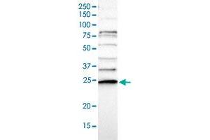 Western blot analysis of Human cell line RT-4 with CD34 polyclonal antibody  at 1:100-1:250 dilution. (CDC34 antibody)