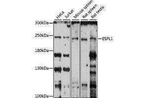 Western blot analysis of extracts of various cell lines, using ESPL1 antibody (ABIN7267070) at 1:1000 dilution. (Separase antibody  (AA 1220-1500))