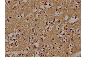 IHC image of ABIN7139735 diluted at 1:100 and staining in paraffin-embedded human brain tissue performed on a Leica BondTM system. (AXIN2 antibody  (AA 56-73))
