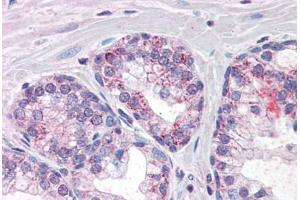Human Prostate (formalin-fixed, paraffin-embedded) stained with PDE11A antibody ABIN337393 at 10 ug/ml followed by biotinylated anti-goat IgG secondary antibody ABIN481715, alkaline phosphatase-streptavidin and chromogen. (PDE11A antibody  (AA 455-468))