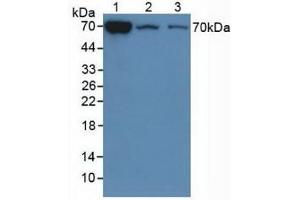 Detection of CHI3L1 in Mouse Liver Tissue, 2: Mouse Lung Tissue,3:Mouse Spleen Tissue using Polyclonal Antibody to Chitinase-3-like Protein 1 (CHI3L1)