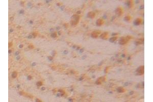 Immunohistochemistry (IHC) image for anti-Lactate Dehydrogenase B (LDHB) (AA 1-334) antibody (ABIN7433972)
