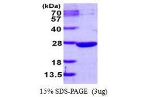 Dual Specificity Protein Phosphatase 13 Isoform A (DUSP13) (AA 1-198) protein (His tag)