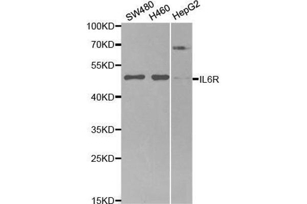 IL-6 Receptor antibody  (AA 20-320)