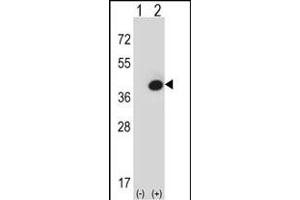 Western blot analysis of FBP1 (arrow) using rabbit polyclonal FBP1 Antibody (Center) (ABIN391577 and ABIN2841512). (FBP1 antibody  (AA 125-156))