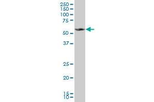 MPP1 monoclonal antibody (M03), clone 2E5. (MPP1 antibody  (AA 1-98))