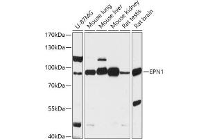 Western blot analysis of extracts of various cell lines, using EPN1 antibody (ABIN7267000) at 1:1000 dilution. (Epsin 1 antibody  (AA 130-180))