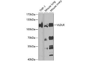 Western blot analysis of extracts of various cell lines, using VLDLR antibody (ABIN7271310) at 1:1000 dilution. (VLDLR antibody  (AA 20-210))