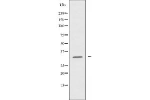 Western blot analysis of extracts from HeLa cells using Cytochrome c-type Heme Lyase antibody. (HCCS antibody  (Internal Region))