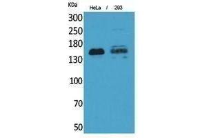 Western Blotting (WB) image for anti-Protein tyrosine Phosphatase, Receptor Type, J (PTPRJ) (Internal Region) antibody (ABIN6285228)
