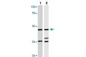 Western blot analysis of HeLa (lane 1) and A-549 (lane 2) cell lysate with BRS3 polyclonal antibody  at 1:500 dilution. (BRS3 antibody)