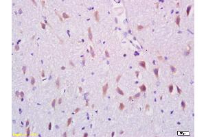 Paraformaldehyde-fixed, paraffin embedded Rat brain Antigen retrieval by boiling in sodium citrate buffer (pH6. (ARHGAP17 antibody  (AA 451-550))