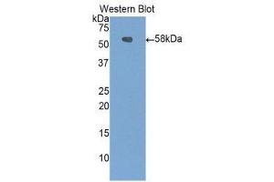 Western Blotting (WB) image for anti-Carboxypeptidase N Subunit 1 (CPN1) (AA 221-449) antibody (ABIN1858481) (CPN1 antibody  (AA 221-449))