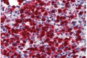 Human Spleen (formalin-fixed, paraffin-embedded) stained with CDA antibody ABIN293380 at 5 ug/ml followed by biotinylated goat anti-rabbit IgG secondary antibody ABIN481713, alkaline phosphatase-streptavidin and chromogen. (CDA antibody  (N-Term))