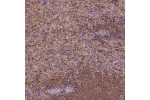Immunohistochemical staining (Formalin-fixed paraffin-embedded sections) of human spleen with MATK polyclonal antibody  shows strong positivity in cells in red pulp.