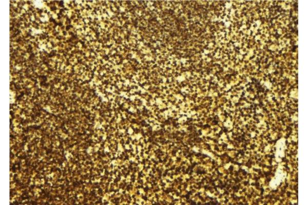PDIK1L antibody  (Internal Region)