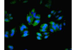 Immunofluorescent analysis of HepG2 cells using ABIN7156460 at dilution of 1:100 and Alexa Fluor 488-congugated AffiniPure Goat Anti-Rabbit IgG(H+L) (ITGAL antibody  (AA 201-500))