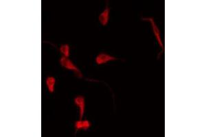 ABIN6269085 staining MDA-MB-231 by IF/ICC.