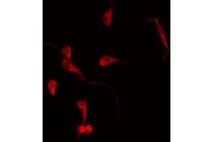 ABIN6269085 staining MDA-MB-231 by IF/ICC. (ErbB2/Her2 antibody  (C-Term))