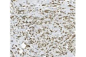 IHC analysis of PRDM5 using anti-PRDM5 antibody (ABIN7600853).