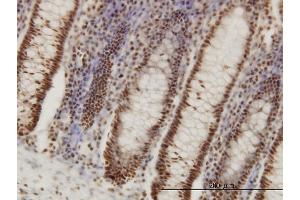 Immunoperoxidase of monoclonal antibody to PPIG on formalin-fixed paraffin-embedded human colon. (PPIG antibody  (AA 13-106))