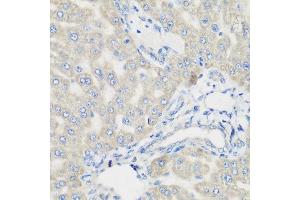 Immunohistochemistry of paraffin-embedded rat liver using PYCR1 antibody at dilution of 1:200 (40x lens).