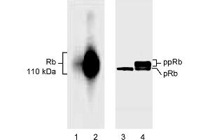 Western Blotting (WB) image for anti-Retinoblastoma 1 (RB1) (AA 514-610), (underphosphorylated) antibody (ABIN967418) (Retinoblastoma 1 antibody  (underphosphorylated))