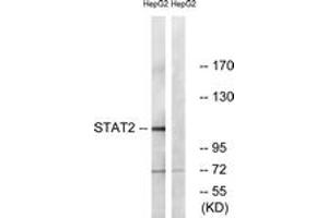 Western blot analysis of extracts from HepG2, using STAT2 (Ab-690) Antibody.