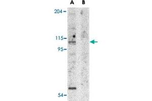 Western blot analysis of APAF1 in K-562 cell lysate with APAF1 polyclonal antibody  at 1 ug/mL in the (A) absence and (B) presence of blocking peptide.