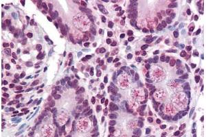 Small intestine, Human: Formalin-Fixed, Paraffin-Embedded (FFPE) (TMPRSS4 antibody  (Internal Region))