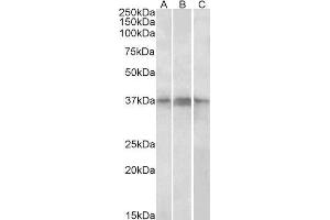 ABIN1686788 (1µg/ml) staining of Daudi,(A) Jurkat (B) and Jurkat nuclear (C) lysates (35µg protein in RIPA buffer). (PHF11 antibody  (Internal Region))