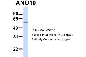 Host:  Rabbit  Target Name:  ANO10  Sample Type:  Human Fetal Heart  Antibody Dilution:  1. (Anoctamin 10 antibody  (C-Term))