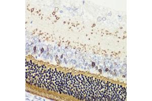 Immunohistochemistry of paraffin-embedded rat retina using RCVRN antibody (ABIN6128676, ABIN6146832, ABIN6146833 and ABIN6222036) at dilution of 1:200 (40x lens). (Recoverin antibody  (AA 1-200))