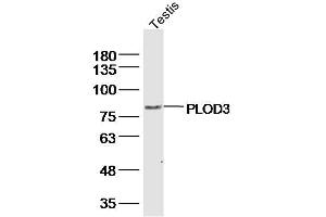 Mouse estis lysates probed with PLOD3 Polyclonal Antibody, Unconjugated  at 1:300 dilution and 4˚C overnight incubation. (PLOD3 antibody  (AA 551-650))