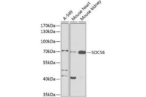 Western blot analysis of extracts of various cell lines, using SOCS6 antibody (ABIN6128785, ABIN6148273, ABIN6148274 and ABIN6225294) at 1:1000 dilution. (SOCS6 antibody  (AA 1-210))