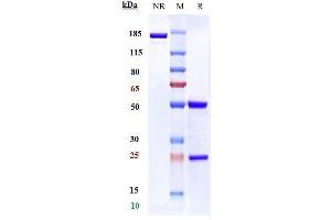Anti-Complement C5aR1 Reference Antibody (G2_anti-C5aR) on SDS-PAGE under reducing (R) condition.