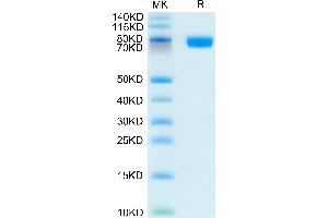 Human CD200 R1 on Tris-Bis PAGE under reduced condition. (CD200R1 Protein (AA 27-266) (Fc Tag))