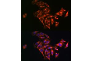 Immunofluorescence analysis of U2OS cells using Fatty Acid Synthase (FASN) Rabbit pAb (ABIN3020990, ABIN3020991, ABIN3020992 and ABIN6213855) at dilution of 1:100 (40x lens). (Fatty Acid Synthase antibody  (AA 2212-2511))