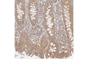 Immunohistochemical staining of human appendix with KCMF1 polyclonal antibody  shows moderate cytoplasmic positivity in glandular cells at 1:200-1:500 dilution.