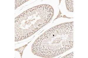 WDR92 antibody